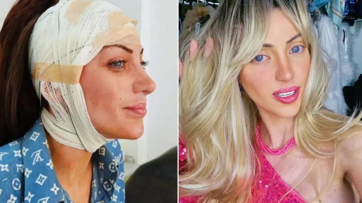 barbie bebege benzemek icin 27 kez ameliyat oldu brezilyali fenomen 31 yasinda hayatini kaybetti N52UsrmG.jpg